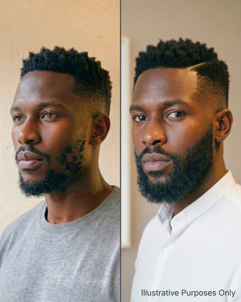 Vitalis Fortifying Beard Growth Serum